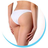 aumento dei glutei tunisia - Aumento dei glutei - chirurgia estetica tunisia